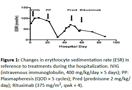 autoimmunediseases-Changes-erythrocyte