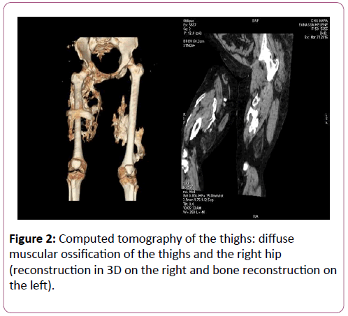 autoimmunediseases-Computed-tomography