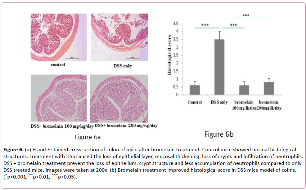 autoimmunediseases-histological-score